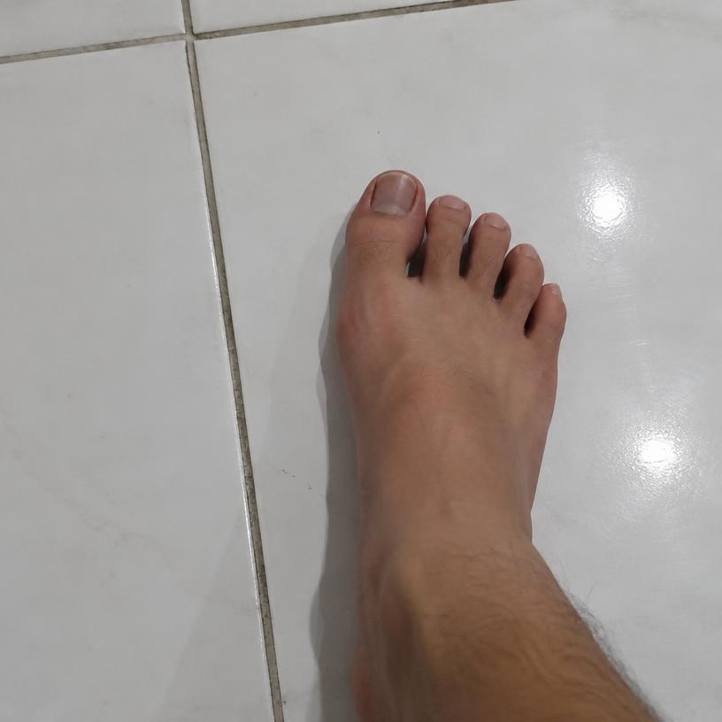 TOE #0063